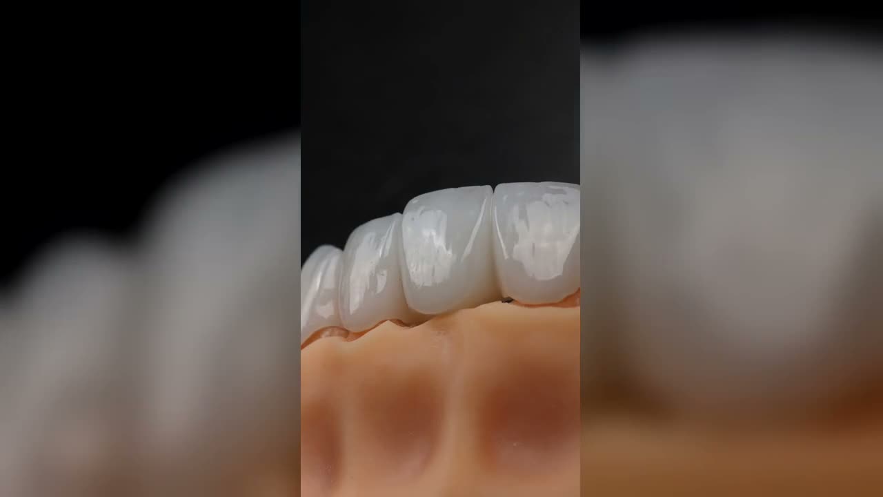 Blanchiment dentaire — dentiste à Marrakech, clinique dentaire Ocre à Guéliz